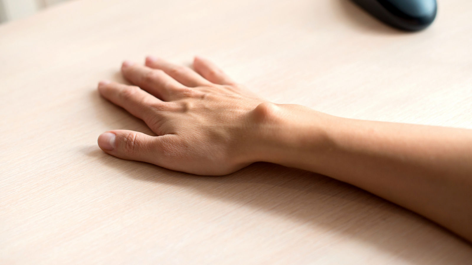 Female hand with a hygroma. Pain. Wrist ganglion cyst. Computer mouse