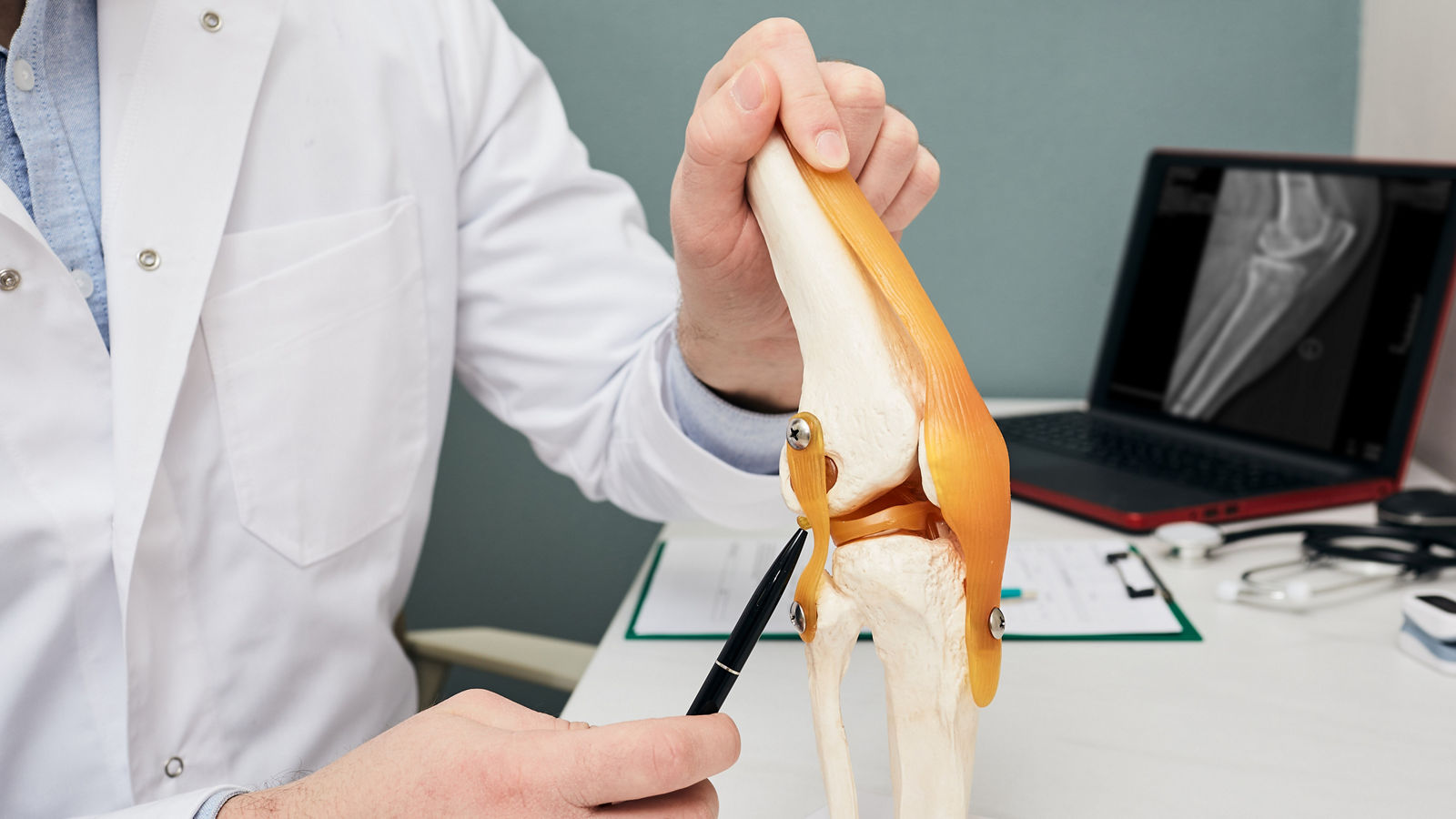 Human cruciate ligament injury treatment concept. Orthopedist showing to cruciate ligament in a knee-joint medical teaching model, close-up