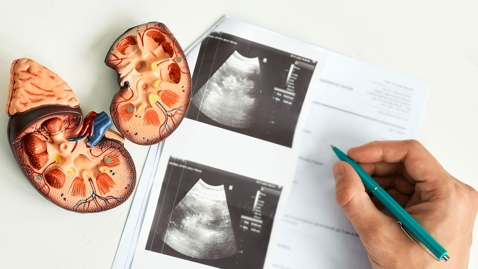 Kidney ultrasound. Doctor analyzing of patient kidney health using kidney ultrasound
