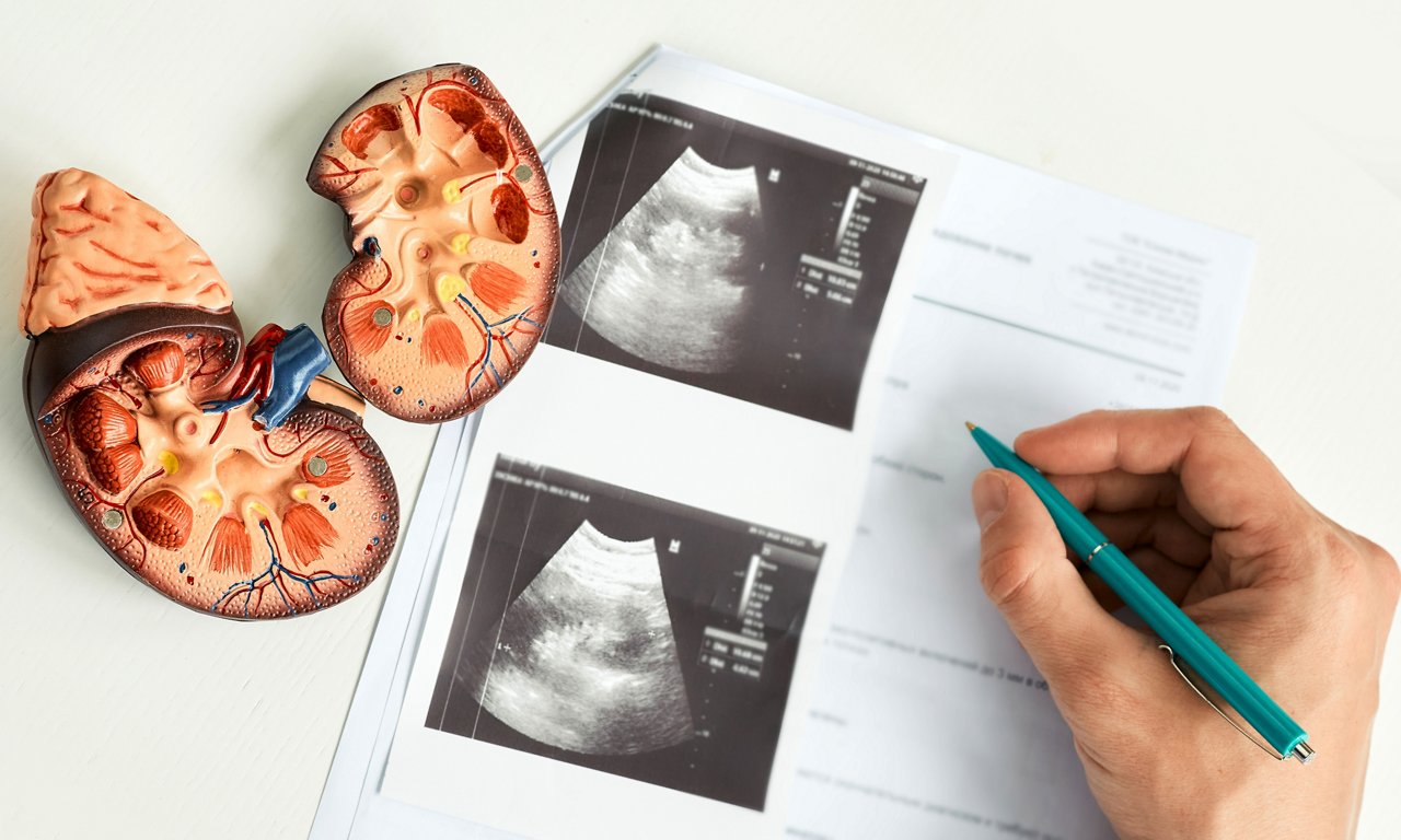 Kidney ultrasound. Doctor analyzing of patient kidney health using kidney ultrasound