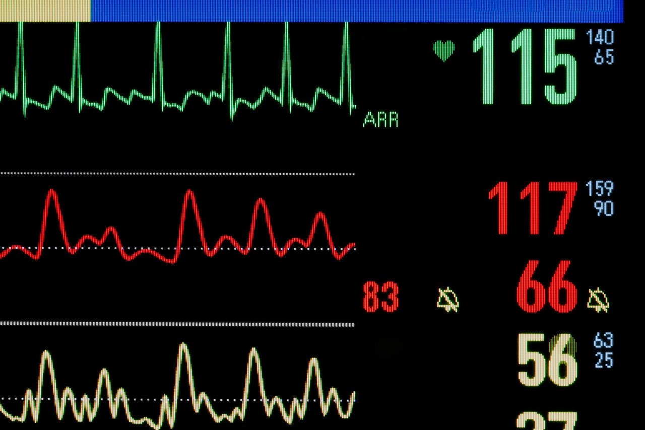 Medical Monitor. Close-up photos.