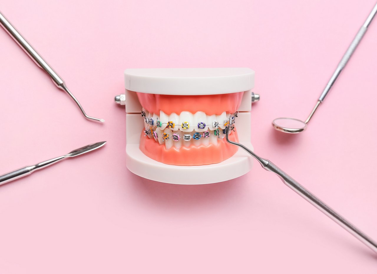 Model of jaw with dental braces and dentist tools on pink background