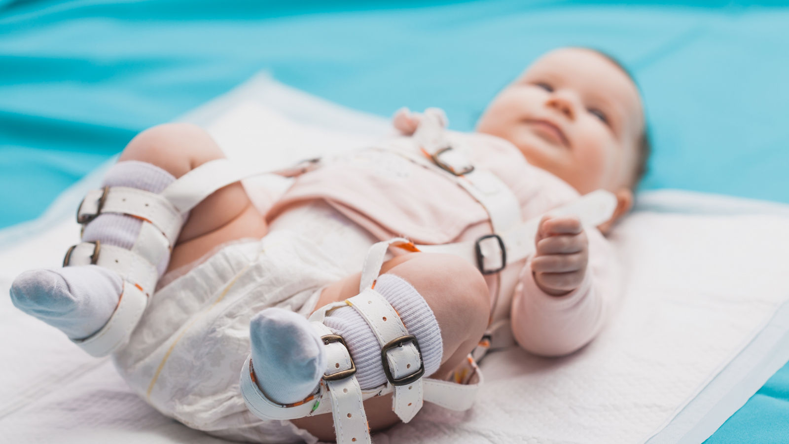 A baby wearing a harness that corrects hip dysplasia