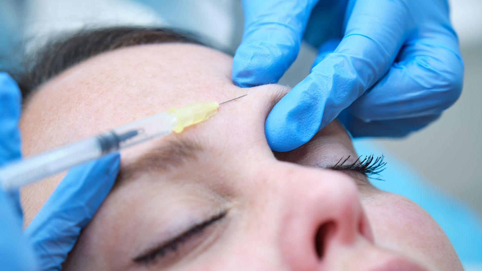 injecting botulinum toxin into corrugator brow