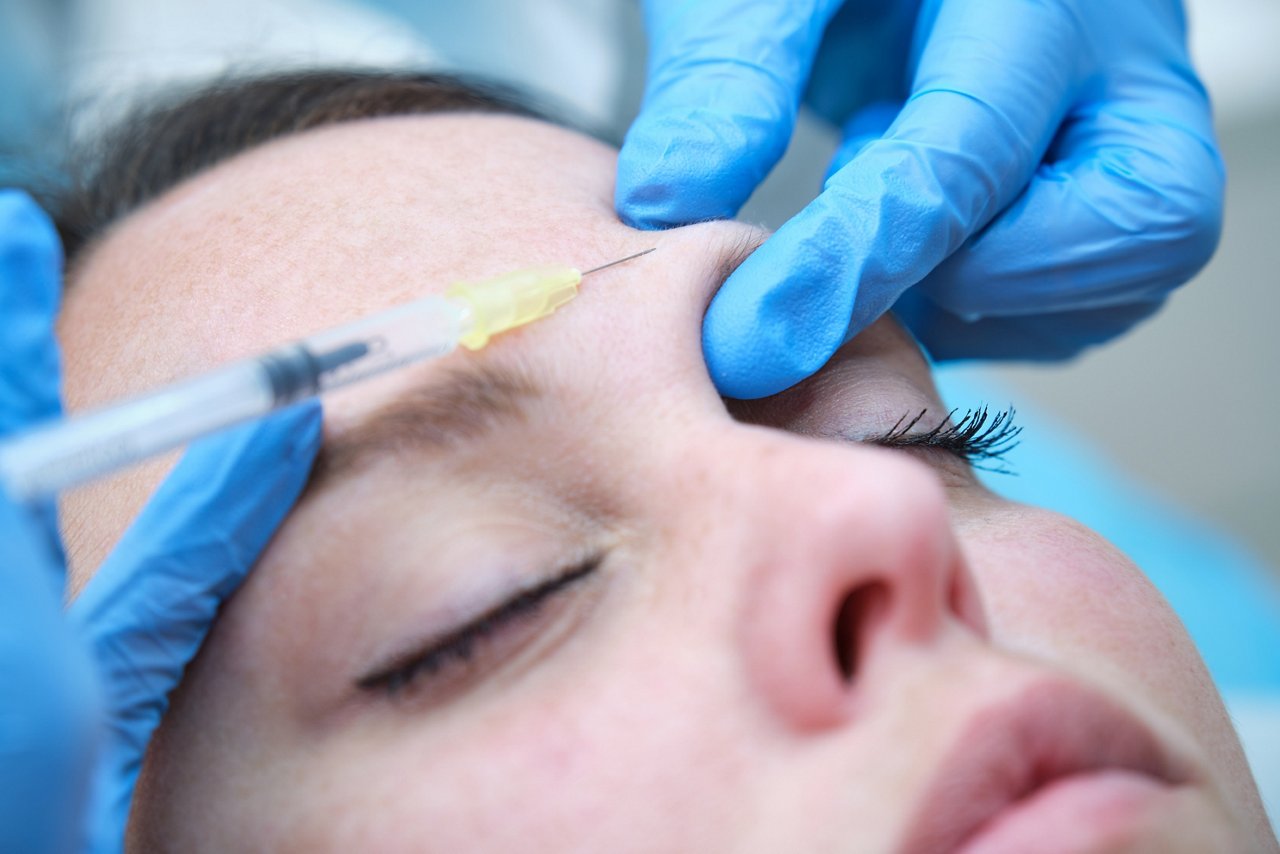 injecting botulinum toxin in the corrugator of the eyebrow of a girl with her eyes closed
