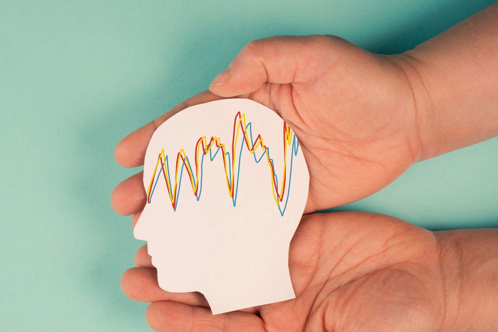 Epilepsie ist eine Erkrankung, bei der das Gehirn oder einzelne Hirnbereiche übermäßig aktiv sind und zu viele Signale abgeben.