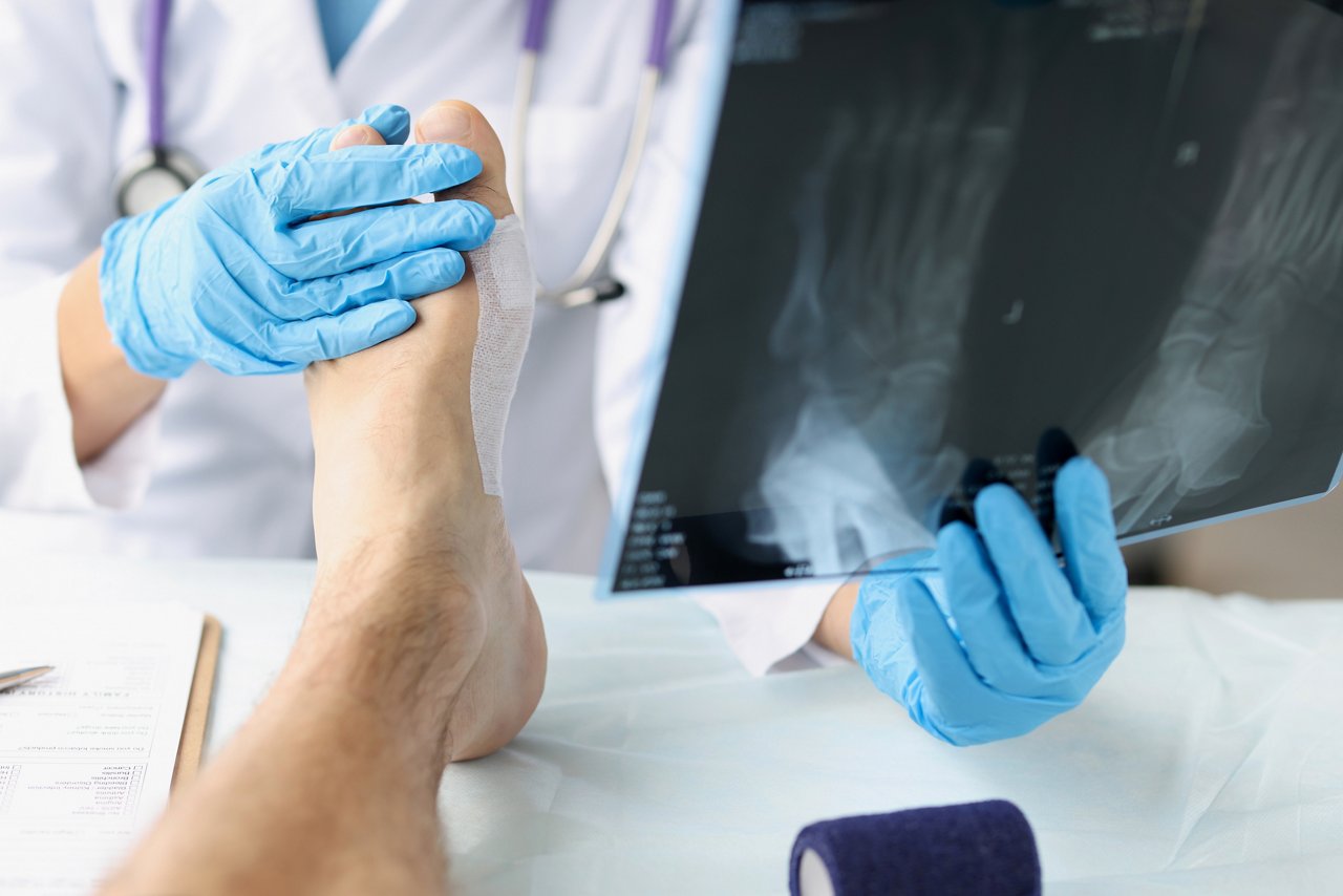 Close-up of traumatologist looking at xray of foot and examining patient. Foot injury and first aid concept