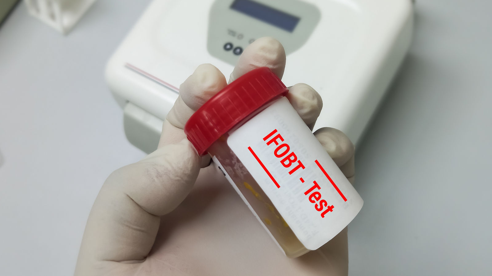Immunofecal occult blood test (IFOBT). Doctor holding sample container with feces or stool for occult blood test (OBT) to diagnosis of colon cancer.
