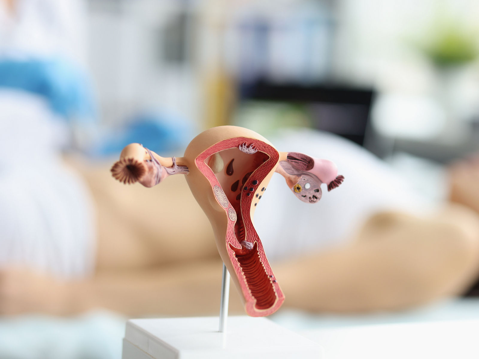 Individuelle Gesundheitsleistungen (IGeL) in der Frauenheilkunde