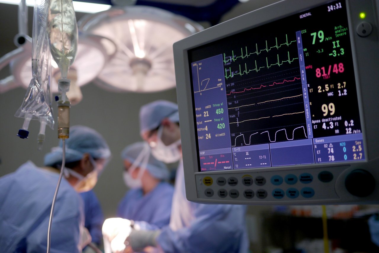 Herzschlag-Monitor-Operationssaal