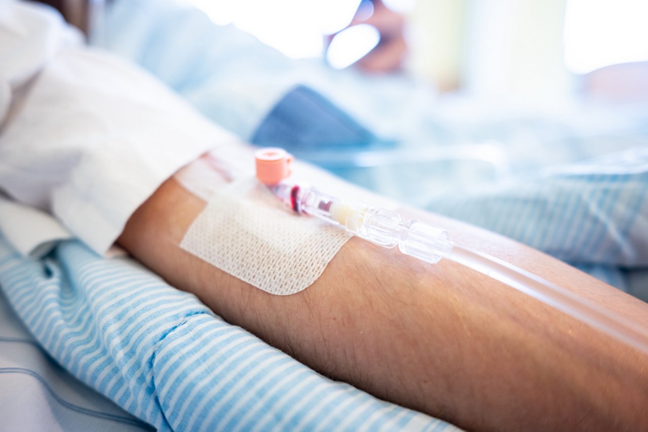 Ein Arm mit Venenkatheter