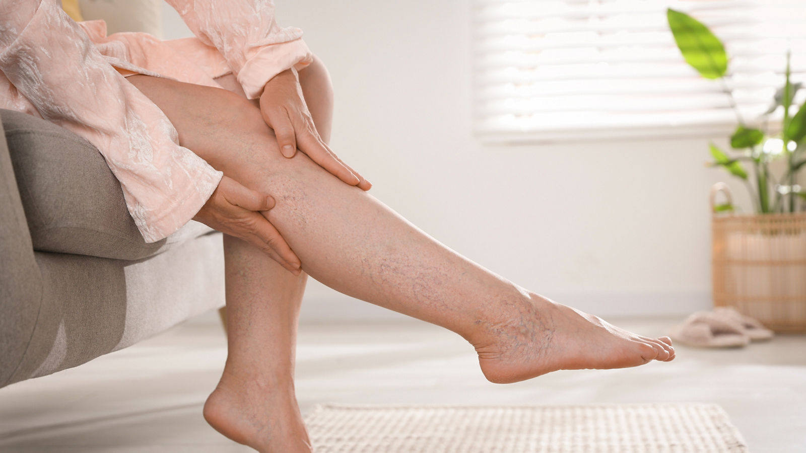 Bein mit sichtbarer Venenerkrankung