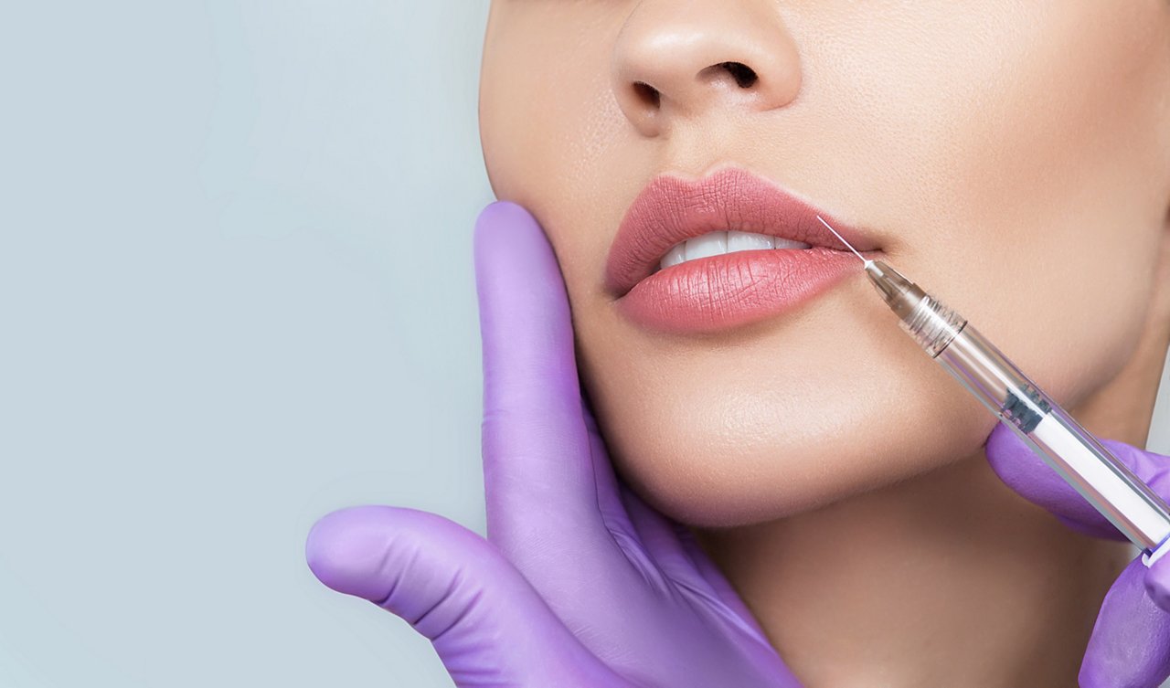 Cropped sensual female lips, procedure lip augmentation. Syringe near womans mouth, injections for increase lips shape