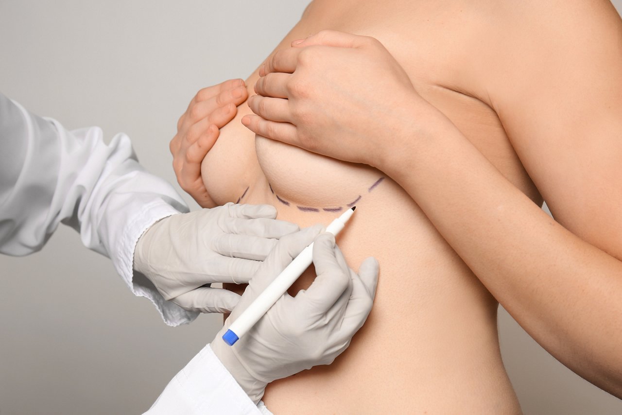 Doctor drawing marks on female breast before cosmetic surgery operation against grey background