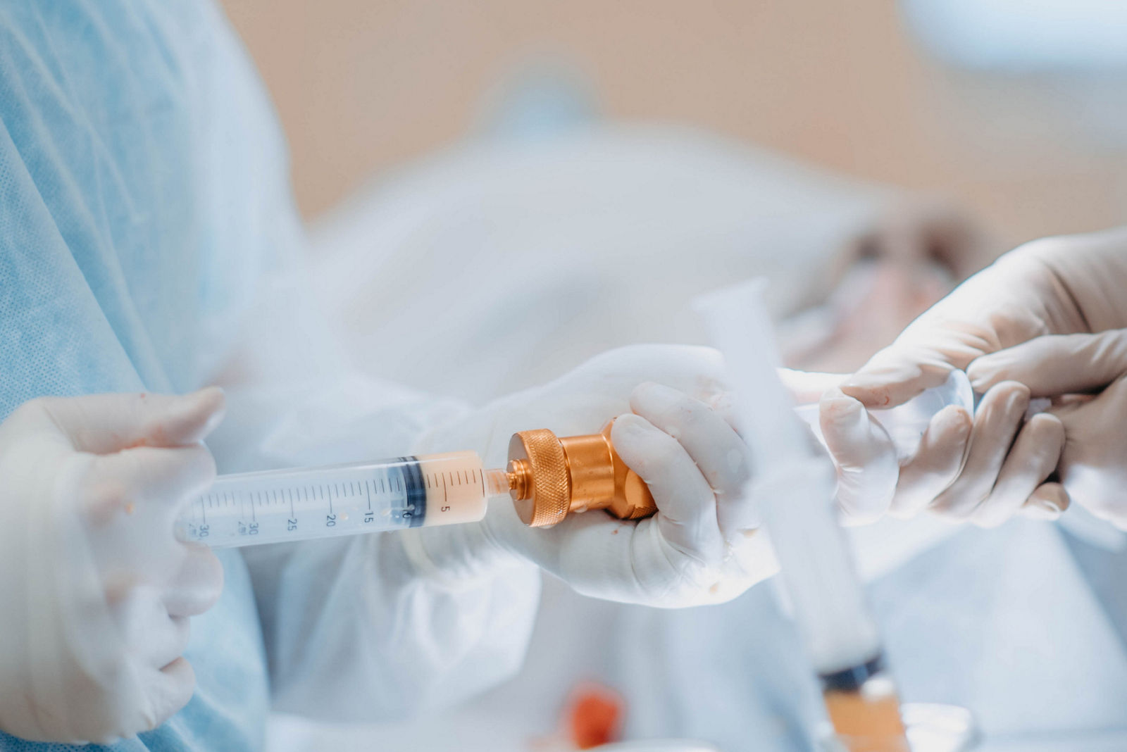 preparation of fat cells for lipofilling in the operating room. Surgical cosmetic surgery to rejuvenate the face with the introduction of stem and fat cells.