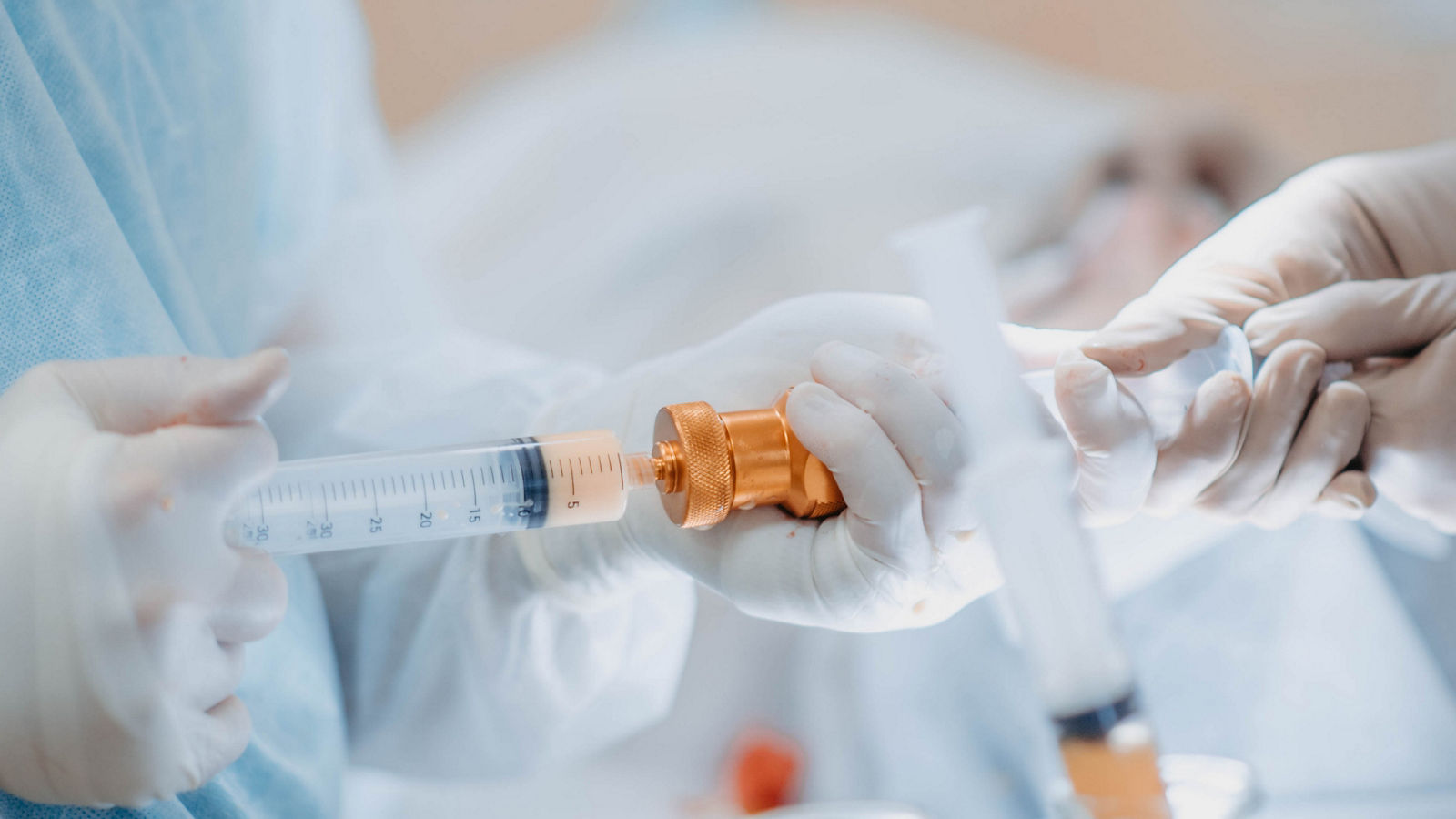 preparation of fat cells for lipofilling in the operating room. Surgical cosmetic surgery to rejuvenate the face with the introduction of stem and fat cells.