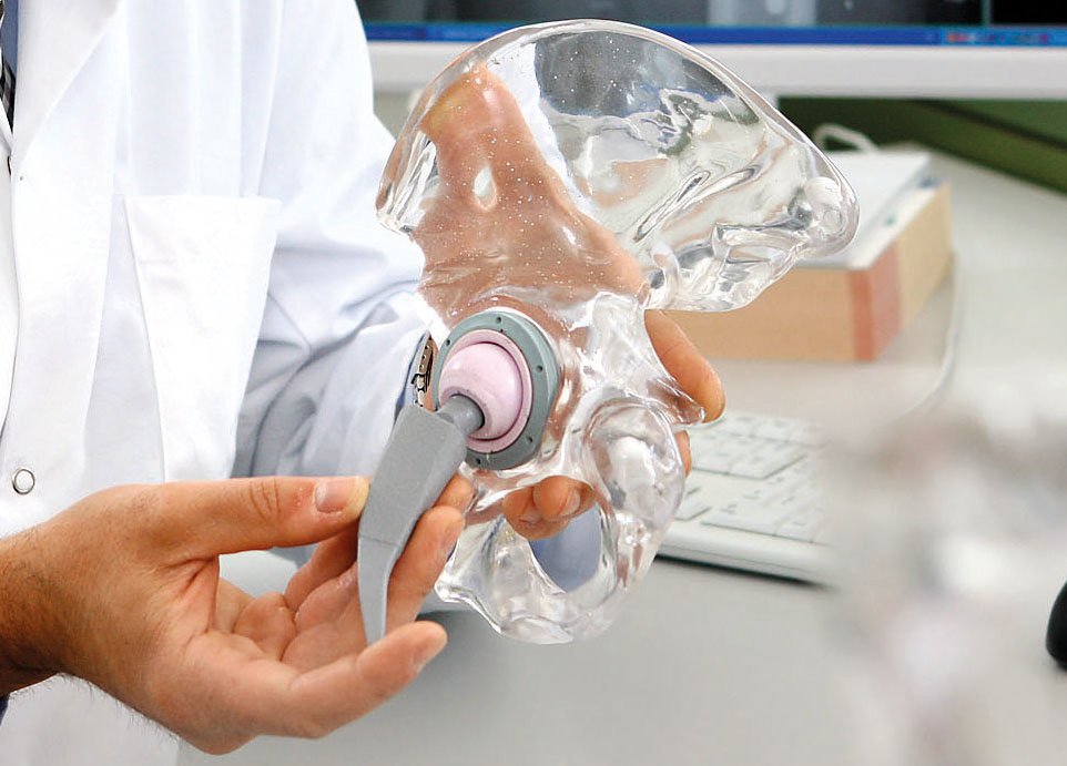 Künstliches Hüftgelenk