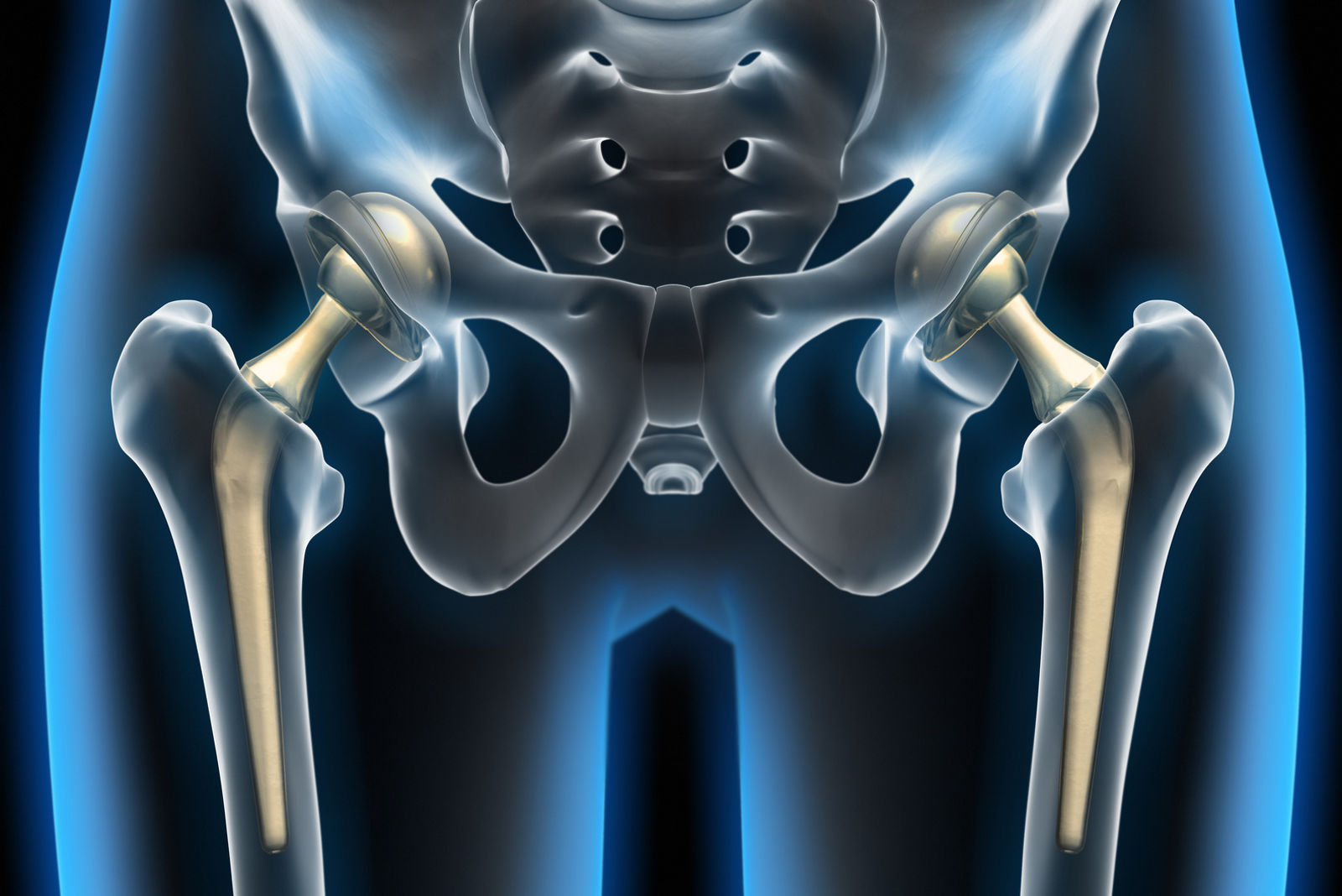 Helios Klinikum Warburg: Digitaler Vortrag zum Thema Gelenkersatz