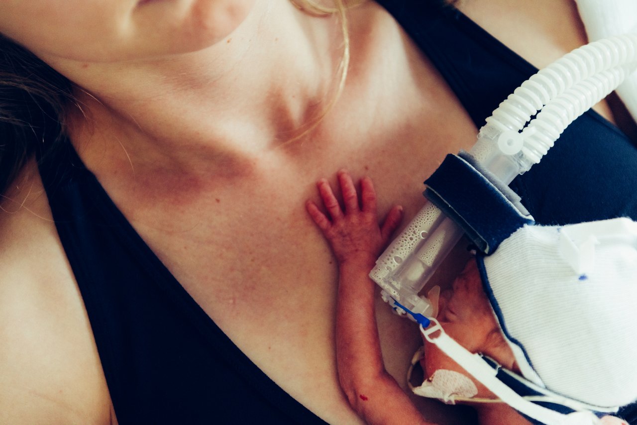 Frühchen liegt auf der Brust der Mutter