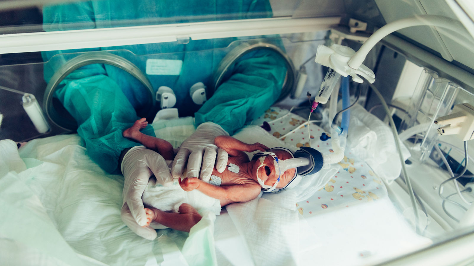 Frühchen liegt im Brutkasten und wird von einer Pflegerin behandelt