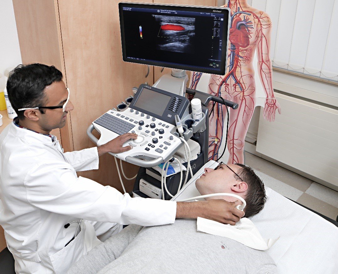 Ultraschalluntersuchung am Hals in der Angiologie