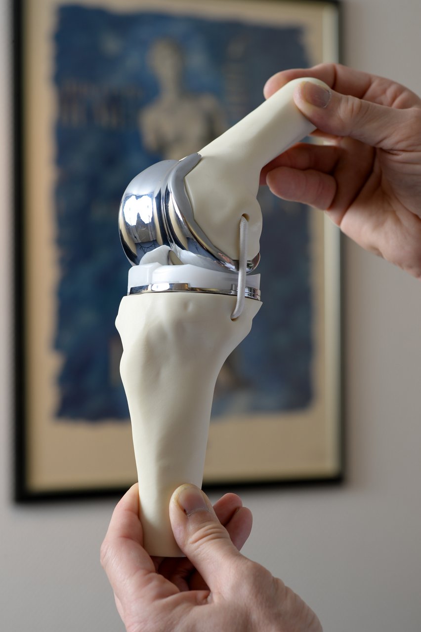 Kniegelenk-Prothese