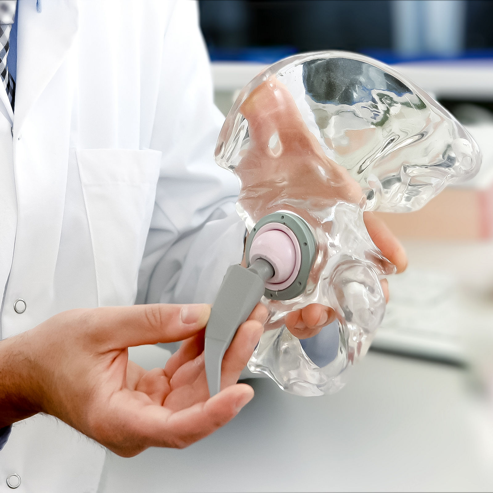 Künstlicher Hüft- & Kniegelenkersatz: Was die moderne Endoprothetik leisten kann