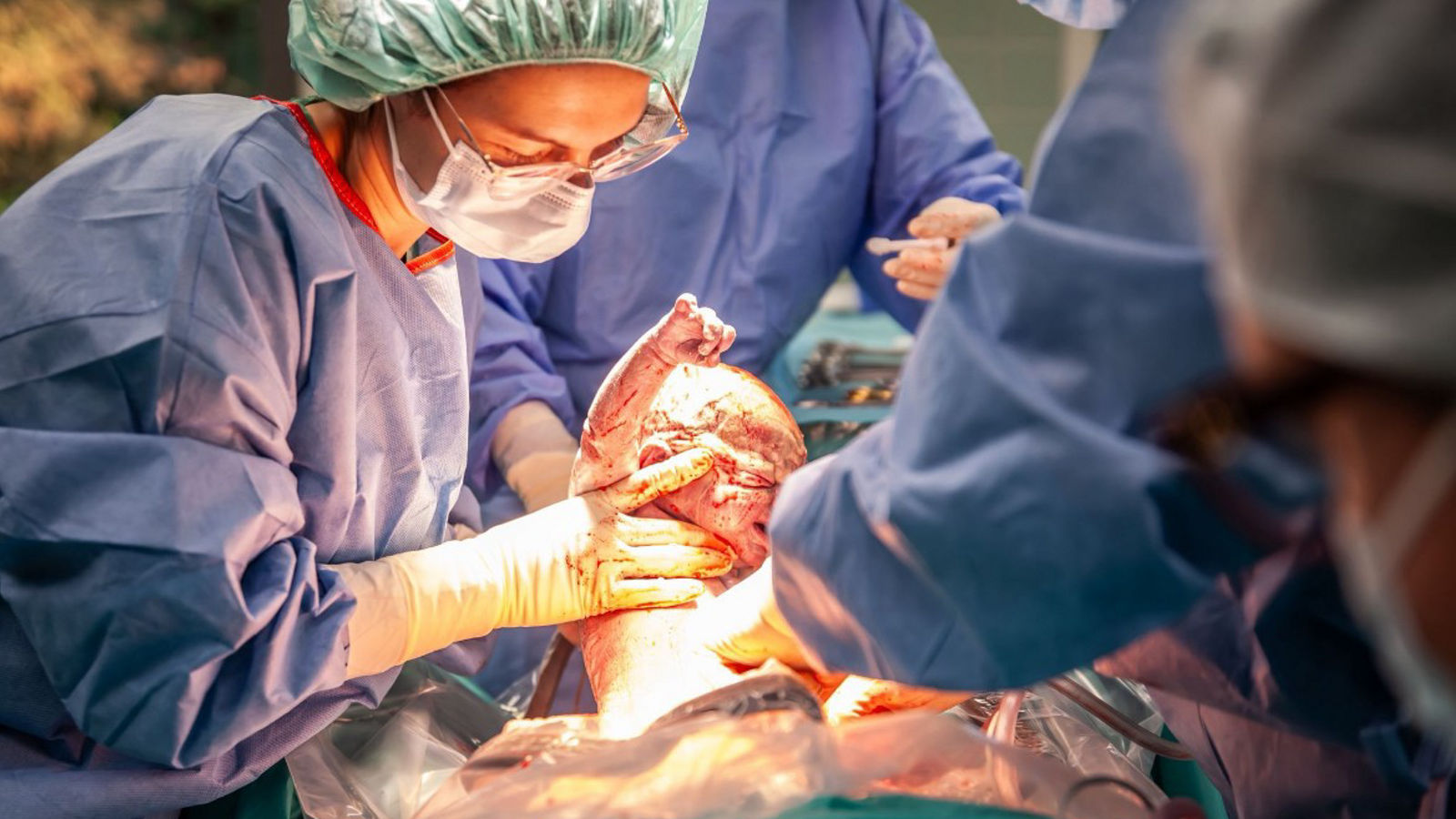 Kaisergeburt in der Helios Klinik Jerichower Land: Wenn der OP-Saal zum ersten gemeinsamen Moment wird 