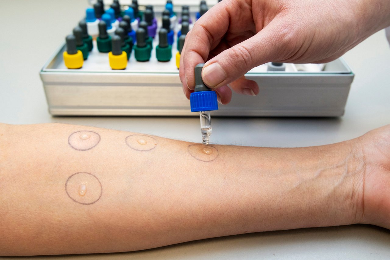 Helios Universitätsklinikum Wuppertal: Dermatologie, 20.02.2019