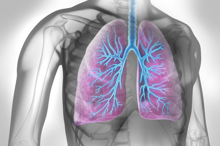 Lungenkrebsfrüherkennung kommt