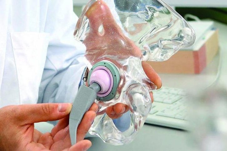 Arzt hält Endoprothese