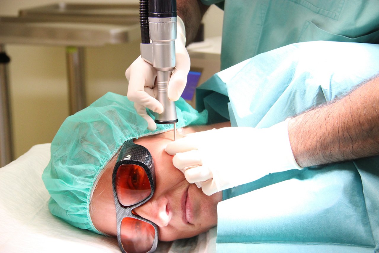 Lasertherapie im Gesicht einer Frau 