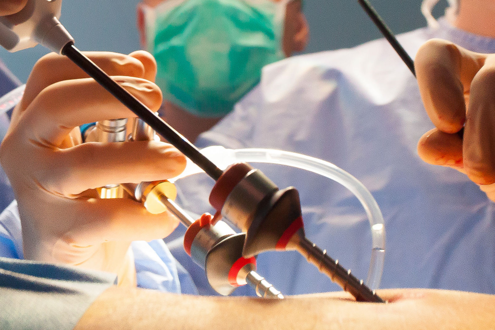 Operation Urologie Zuschnitt