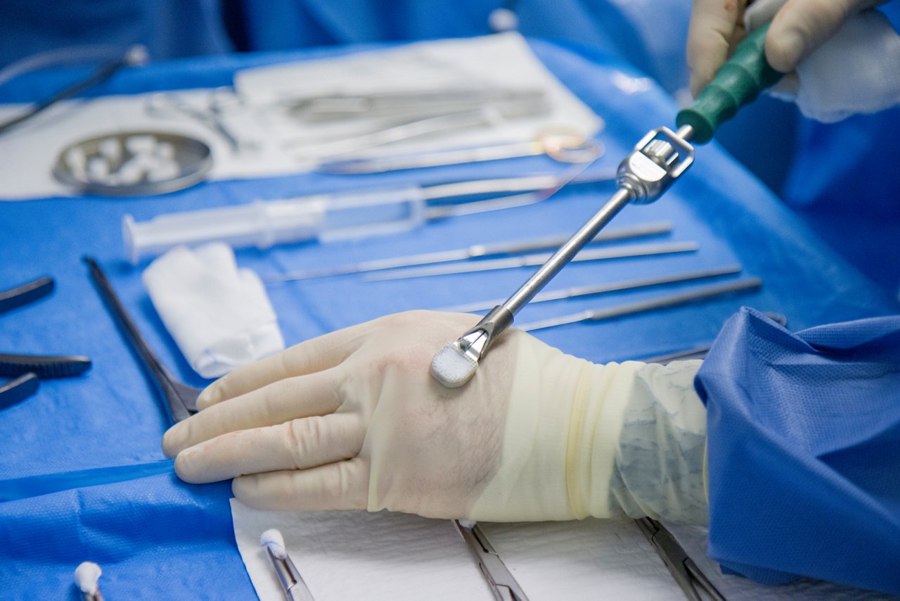 künstliche Bandscheibe Wirbelsäulenchirurgie