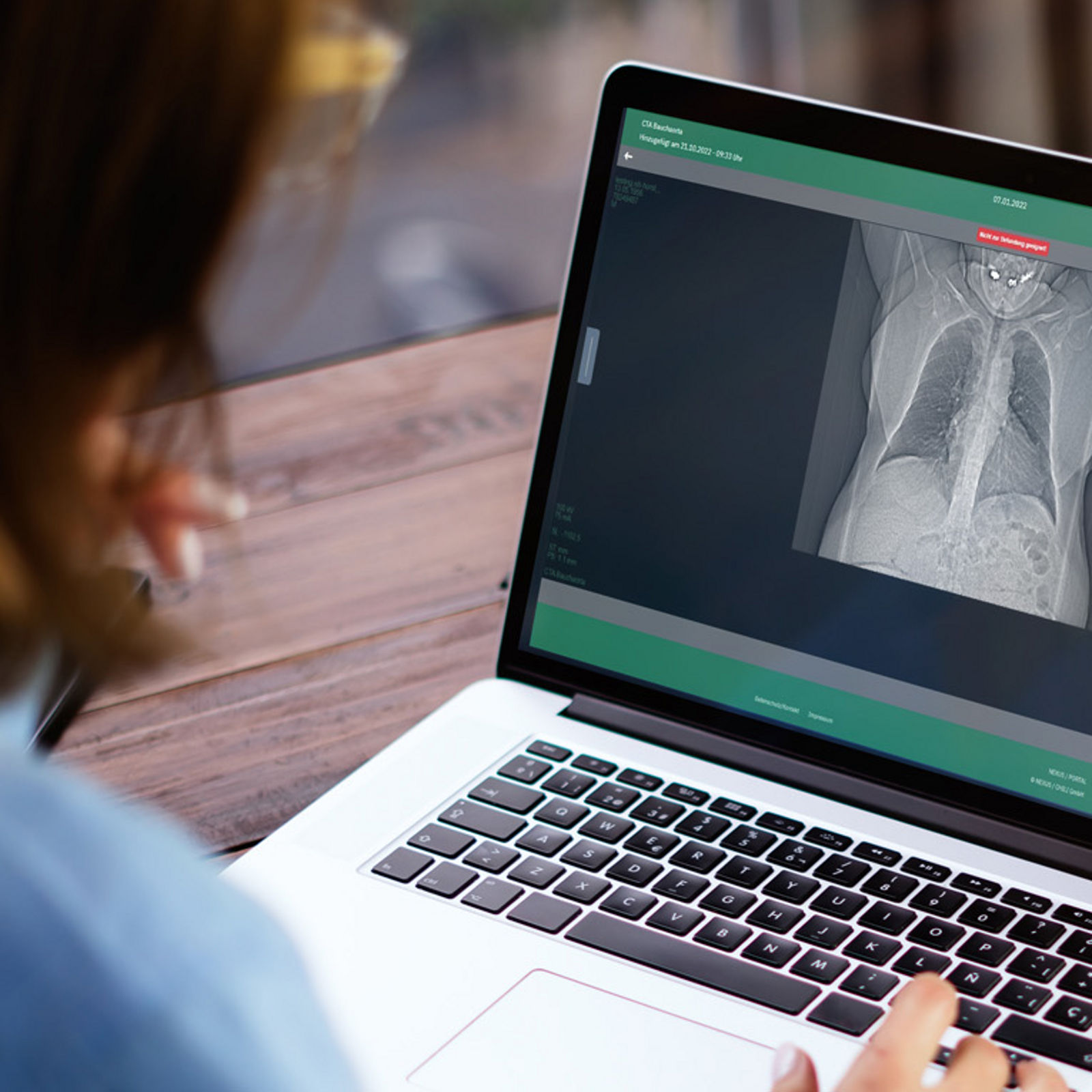Blick über die Schulter einer Person auf ihren Laptopbildschirm. Person ruft auf ihrem Laptop das Bildportal mit ihren Röntgenbildern ab.