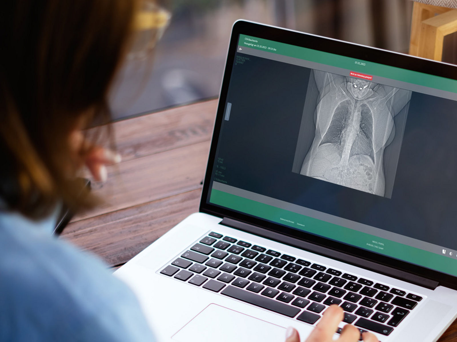 Blick über die Schulter einer Person auf ihren Laptopbildschirm. Person ruft auf ihrem Laptop das Bildportal mit ihren Röntgenbildern ab.