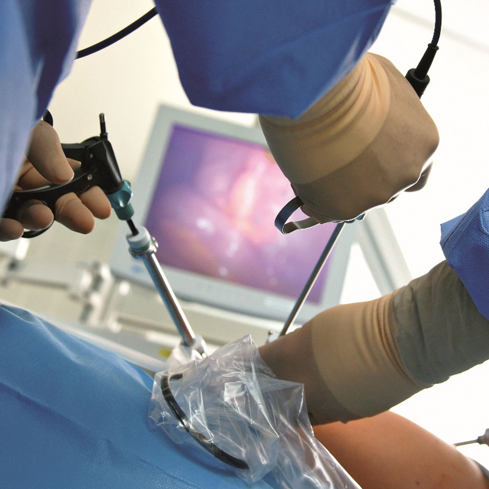 Neue Indikationssprechstunde Viszeralchirurgie und mit zusätzlicher Verstärkung für das Team in der Helios Bördeklinik 
