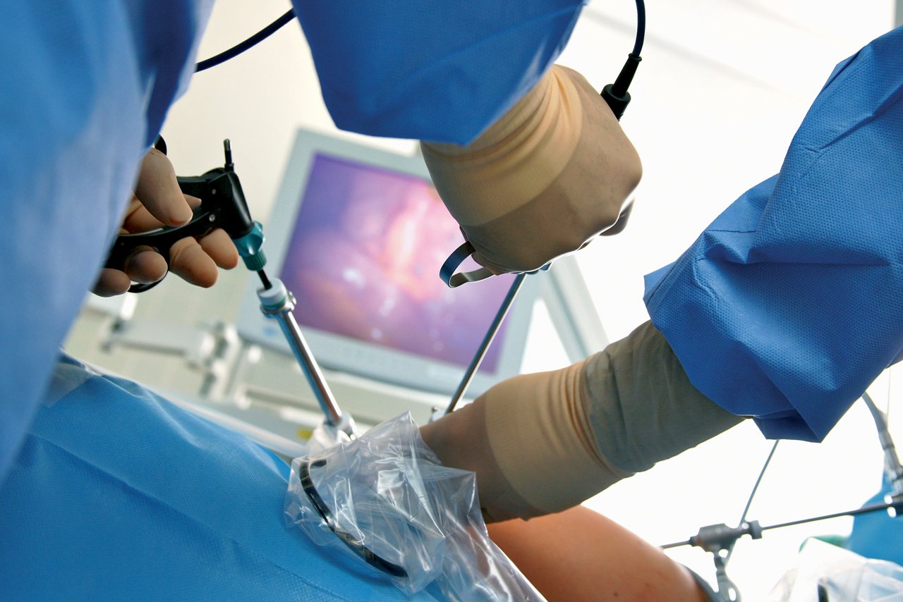 Einblick in eine OP - Chirurg im Operationsaal - minimalinvasive Chirurgie