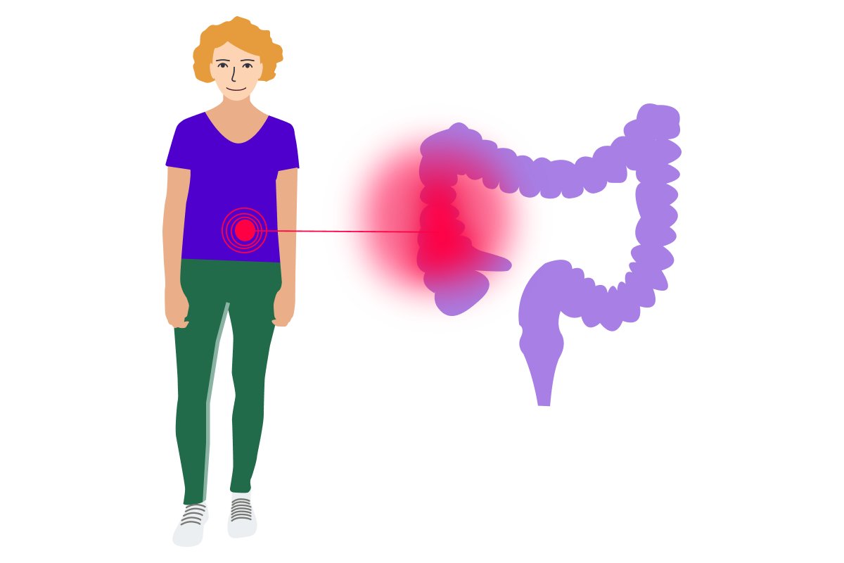 Hannah Helios - Darmkrebs - Vorsorge und Prävention