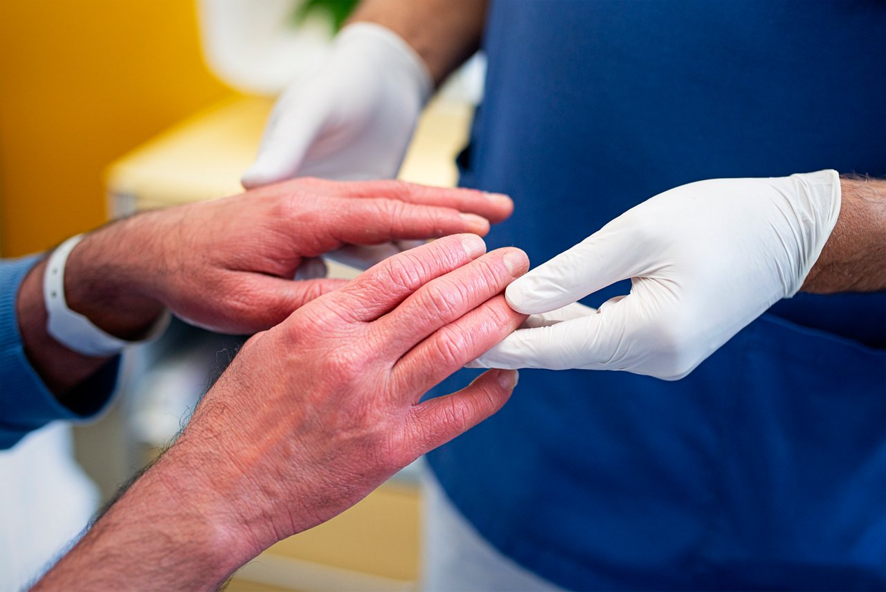 Hände mit dermatologischer Erkrankung Untersuchung