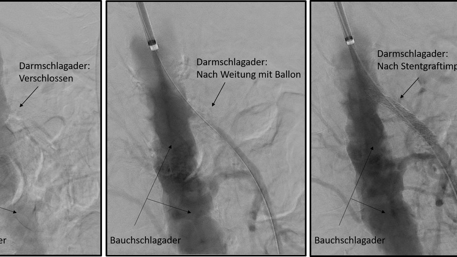 PatGeschichte Gefäßchirurgie