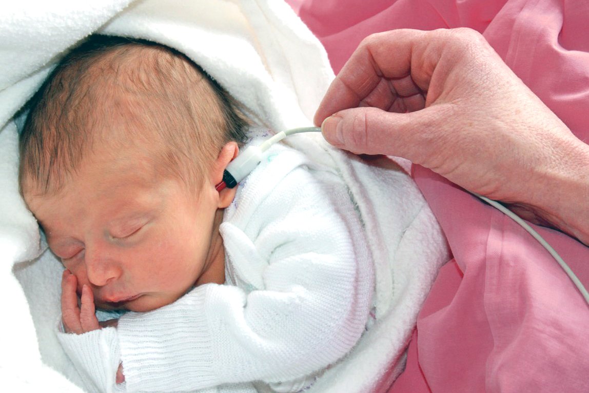 Neugeborenenhörscreening