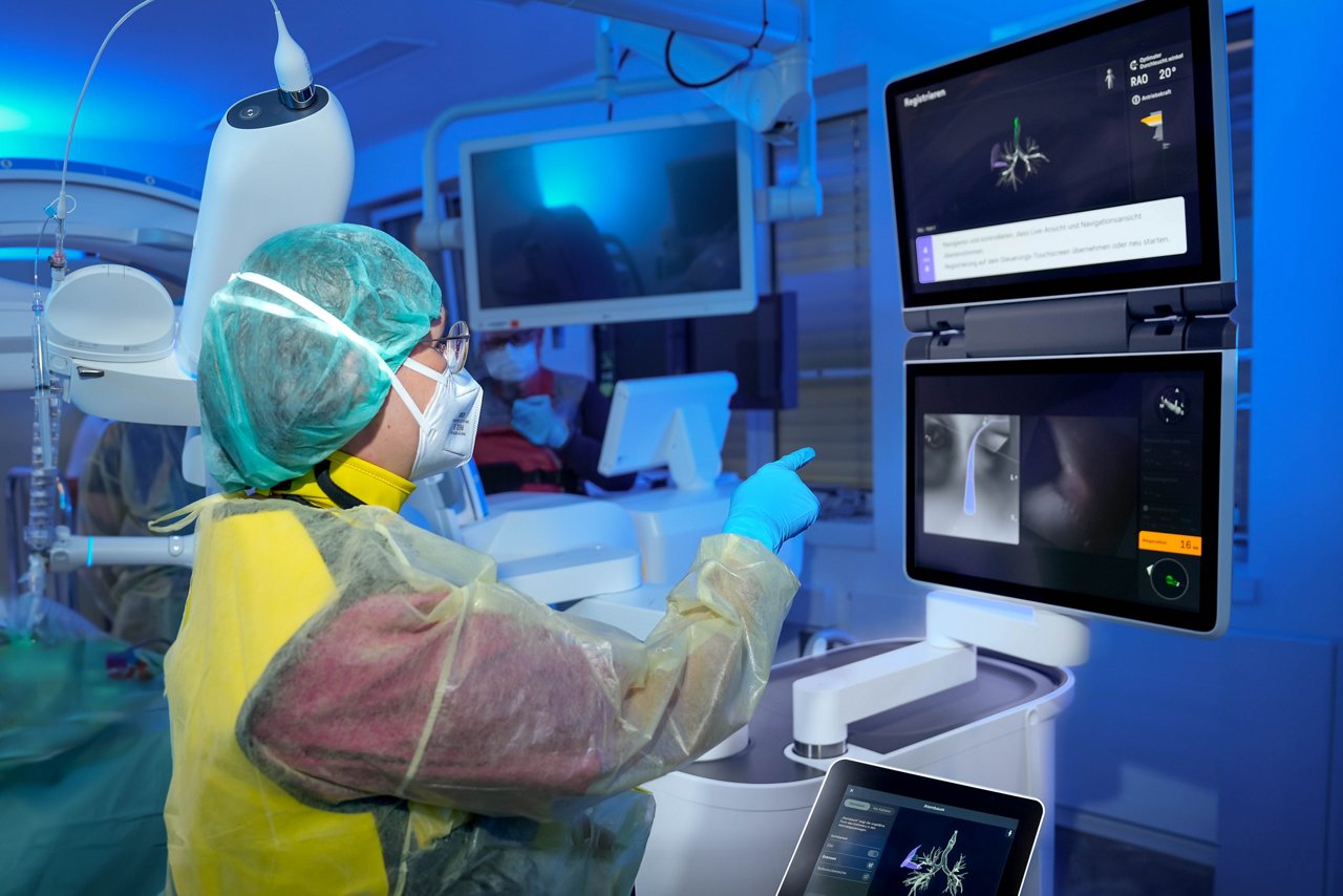 Das neue Ion System eröffnet Ärztinnen und Ärzten erstmals den Zugang zu selbst millimetergroßen Rundherden tief im Lungengewebe.