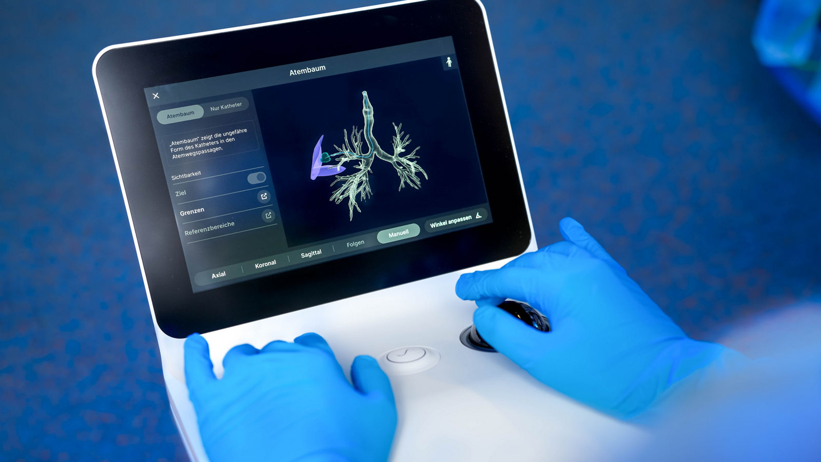 Hightech-Offensive in der Diagnostik an den Helios Lungenkrebszentren 