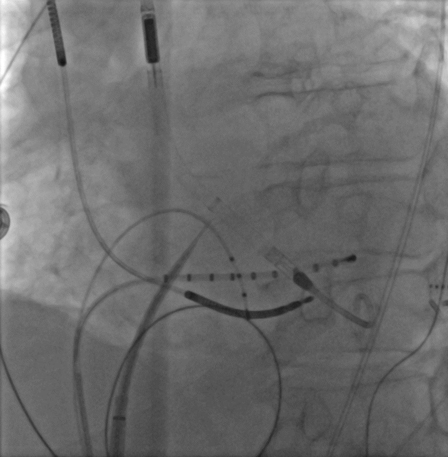 Elektrophysiologie Helmstedt