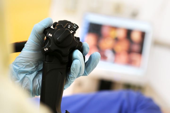 Detailaufnahme: Endoskop in Hand