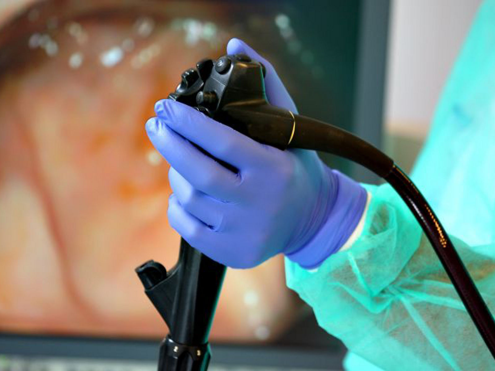 Darmspiegelung: sichere Vorsorge und effektive Therapie