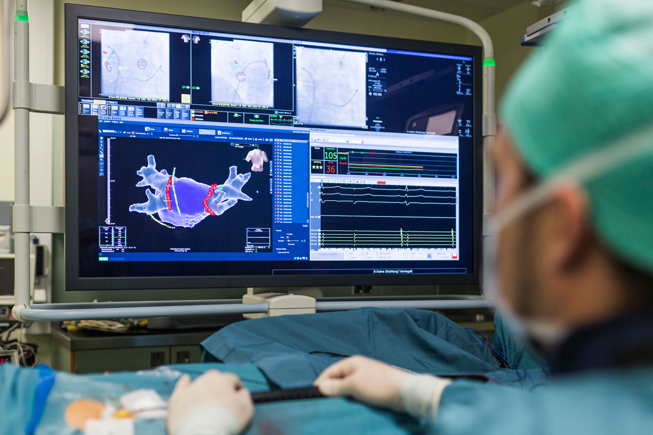 Vorhofflimmer-Ablation: Erfolg mit KI besser vorhersagbar?