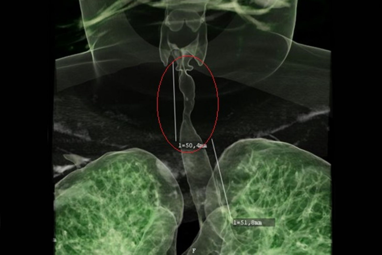 präoperative Diagnostik