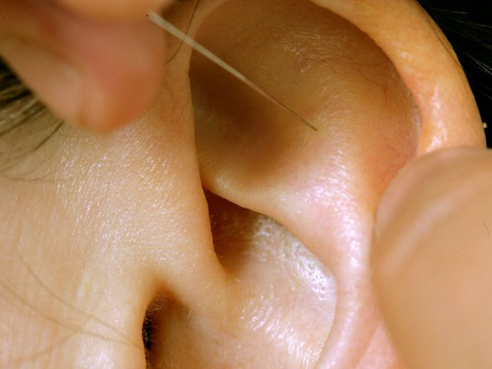 Wann sollten Sie zur stationären multimodalen Schmerztherapie?